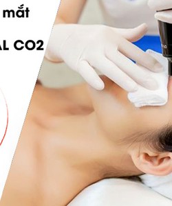 Trị thâm mắt, quầng mắt bằng laser có hiệu quả không