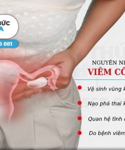 Địa chỉ chữa viêm cổ tử cung hiệu quả nhất tại TP Thanh Hóa