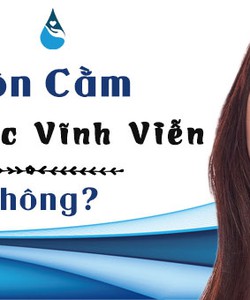 Độn cằm có được vĩnh viễn không