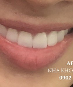 Dịch vụ nha khoa tại TPHCM