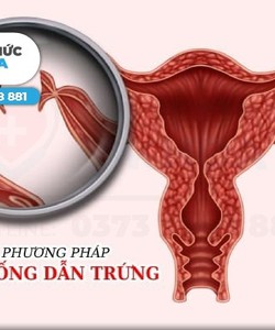 Địa chỉ chữa trị chậm kinh uy tín tại TP Thanh Hóa