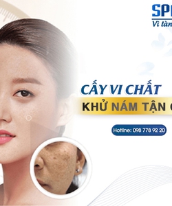 Thẩm Mỹ viện SPALA Điều trị nám tận gốc bằng phương pháp cấy vi chất tái sinh