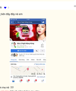 Nâng mũi đẹp tại BVTM NMH