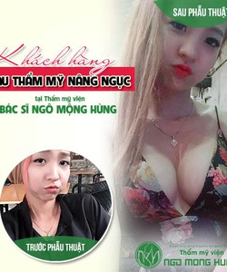 Thuốc nâng ngực full bloom hiệu quả ra sao