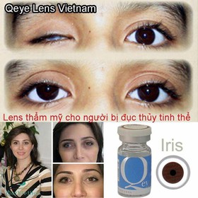 KÍNH ÁP TRÒNG THẨM MỸ mua sắm online 