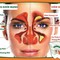 Thảo dược Doctor Ninh trị viêm xoang hiệu quả tốt nhất