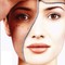 BioSurefaceTM Peel Phép nhiệm màu điều trị nám da hiệu quả