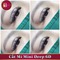 Cắt mí mini deep 6D đẹp vĩnh viễn