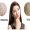 Đã có câu trả lời nám tàn nhang có chữa trị được không
